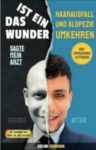 HAARVERLUST UND ALOPEZIE UMKEHREN. Ein Wegweiser, ein umfassender Leitfaden und ein absoluter Schatz an wertvollem und anwendbarem Wissen